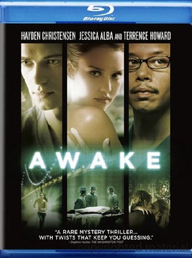 夺命手术Awake